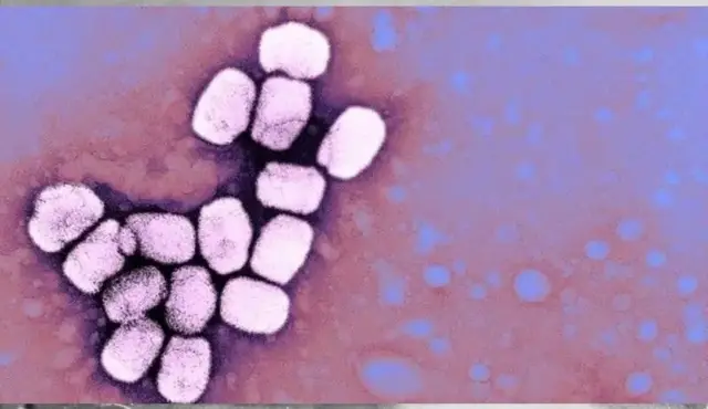 چیچک کے وائرس