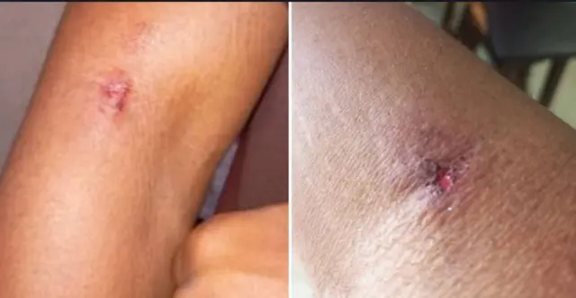 Apa arụ dị n'ahụ Dkta Chukwudi Okoye