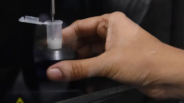 తల్లి పాలు, బ్రెస్ట్ మిల్క్ బ్యాంక్, ఆరోగ్యం, బాలింతలు