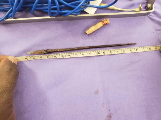 La petite Roukayatou a été touchée à plein coeur par une flèche de 15 centimètres.