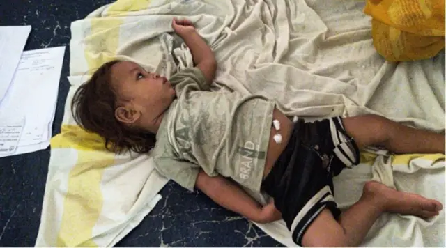 د مار د چیچلو او د مار له‌خوا د چیچلو ترمنځ د زهرو د اغېز په طریقه کې توپیر شته. 