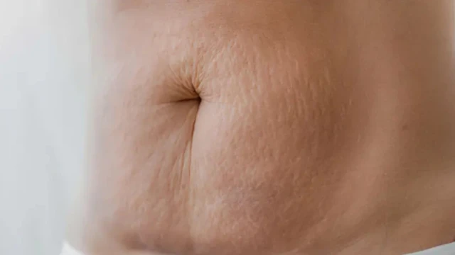 सी-सेक्शन पाउच