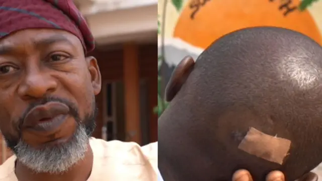 Aworan wọn araalu Offa