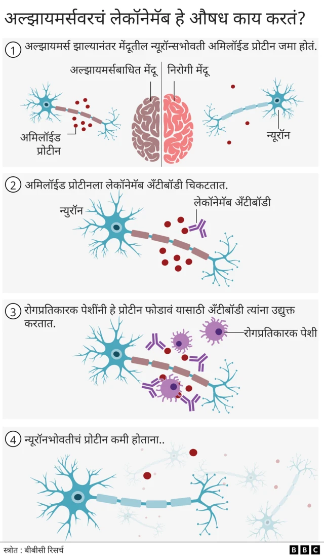अल्झायमर्स