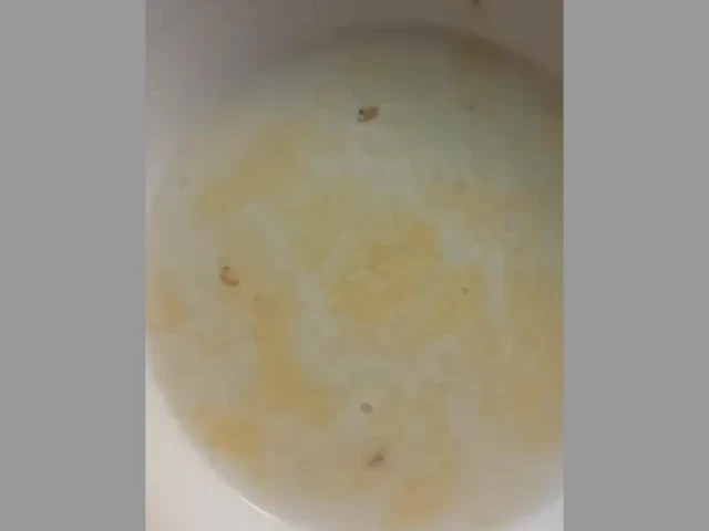 Балдарга деп бериле турган боткодон табылган курттар