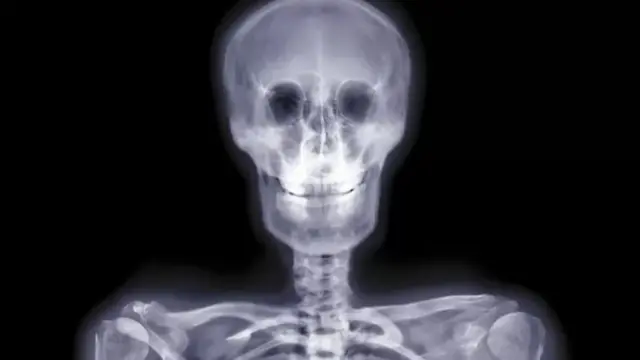 कॅप्सूल 