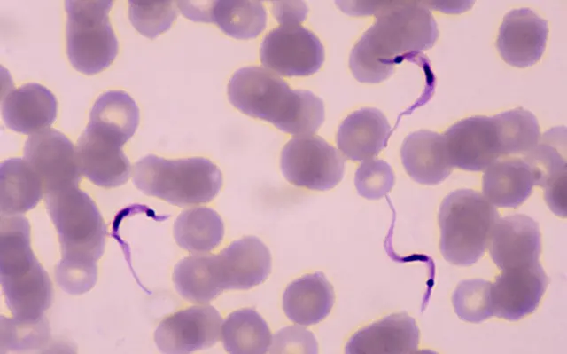 Trypanosoma cruzi