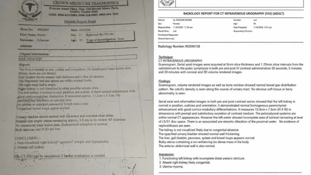 Some recent scan wey tok say dem no fit see one kidney clear for Barira bodi