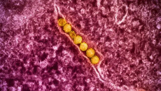 Mikroskopla görülen Batı Nil Virüsü partikülleri 