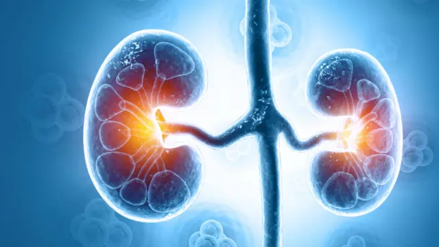 ਗੁਰਦੇ ਦੀ ਪੱਥਰੀ
