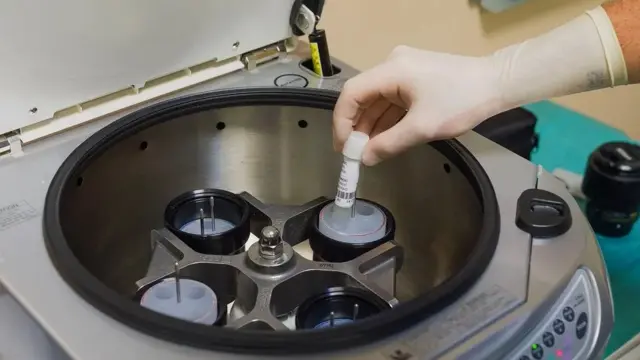 Kesuburan pria juga mulai menurun seiring bertambahnya usia.