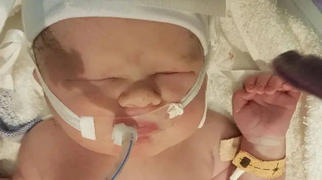 ویلو کو پیدائش کے فوراً بعد انتہائی نگہداشت کی ضرورت تھی