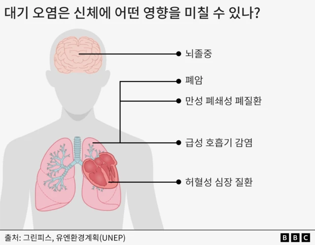 뇌졸중, 폐암 등 대기 오염이 신체에 미칠 수 있는 영향