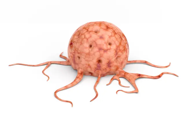 Pancreatic Cancer स्वादुपिंड, इन्शुलिन, कर्करोग, Insulin