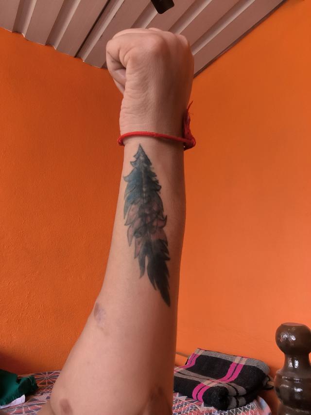 கை மாற்று அறுவை சிகிச்சை