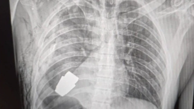 ਗ੍ਰੇਨੇਡ