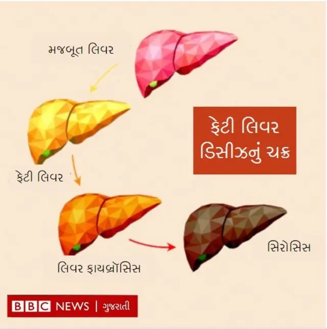 તૈલી ખોરાકમાં રહેલી ચરબી આપણાં શરીરમાં કિડની અને લીવર (યકૃત) જેવા અંગોને અસર કરે છે