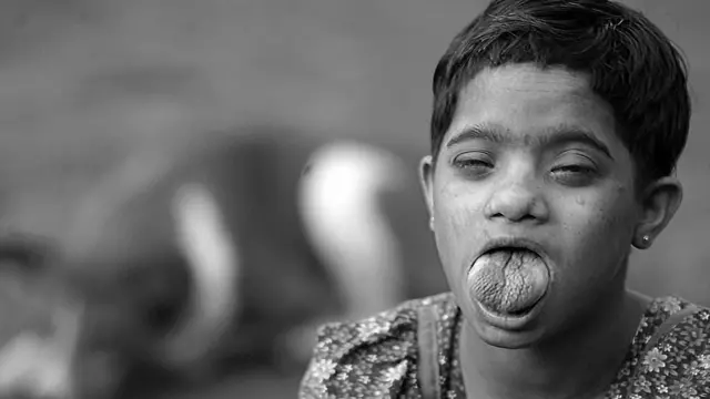 মিজ. কভিথা যে বাড়িতে থাকত, তার কাছেই ছিল কাজু খেত। ফসলের ওপরে এন্ডোসালফান ছড়িয়ে দেওয়ার জন্য যখন হেলিকপ্টার উড়ে আসত, তা দেখে দারুণ আনন্দ পেত সে। ধীরে ধীরে তার রোগপ্রতিরোধের ক্ষমতা কমে আসে, জিভ ফুলে ওঠে। মুখ বন্ধ করতে পারত না সে। কভিথার এই ছবিটি তার মৃত্যুর চার বছর আগে, ২০০৬ সালে তোলা