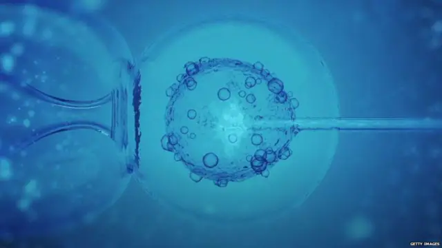 ਆਰਥਿਕ ਸਰਵੇਖਣ 