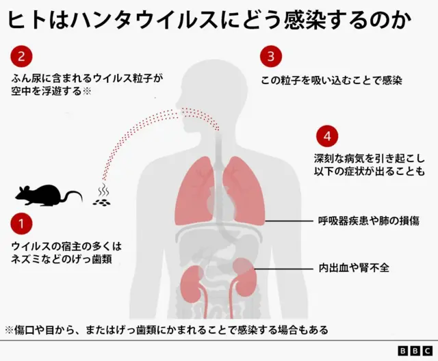 ハンタウイルスのヒトへの感染を説明した図。このウイルスの宿主の多くはネズミなどのげっ歯類。空中に浮遊するふん尿に含まれるウイルス粒子を吸い込むことで人間が感染する。感染すると呼吸器疾患、肺の損傷、内臓の内出血、腎不全と言った深刻な病気を引き起こすことがある。また、ウイルスが傷口や目から入ったり、げっ歯類にかまれるたりすることでも、感染することがある