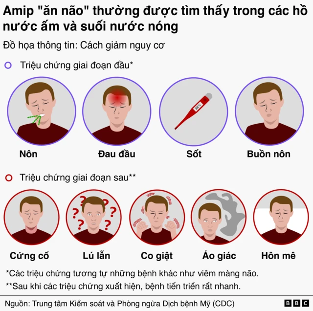 Amip 'ăn não'