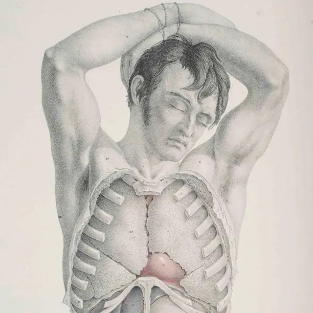 Ilustracija iz knjige Hirurška anatomija Džozefa Maklisa