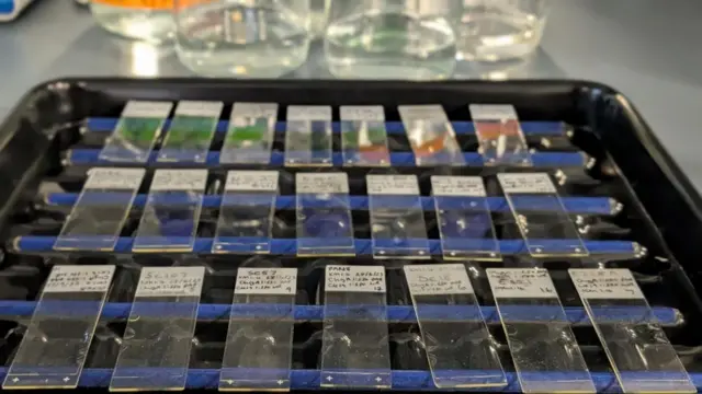 డయాబెటిస్ కారణాలపై పరిశోధన