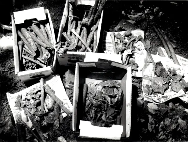 Foto preto e branco mostra caixa com ossos