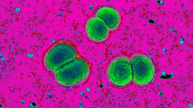 මෙනින්ගොකෝකල්