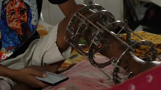 হাসপাতালে এখনো ভর্তি জুলাই আন্দোলনে আহত একজন