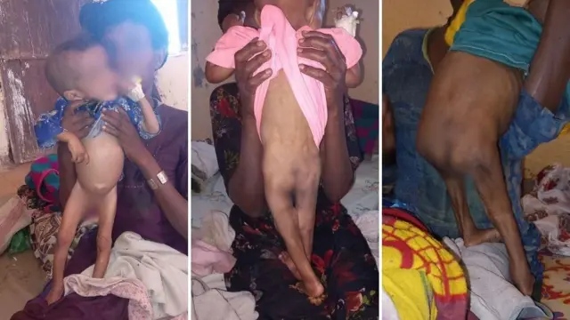 ብኸቢድ ሕጽረት መግቢ ዝተጠቕዑ ህጻናት