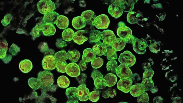 Foto show how di amoeba dey