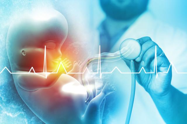 சிசேரியன்