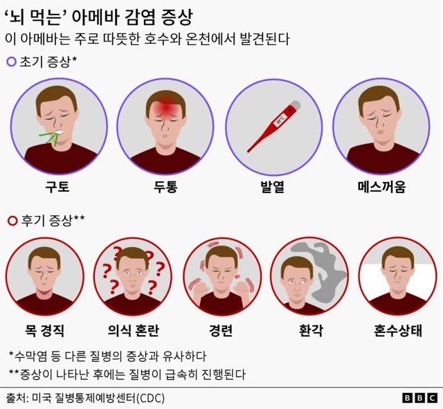 구토, 두통, 발열, 메스꺼움 / 목 경직, 의식 혼란, 발작, 환각, 혼수상태 등의 감염 증상