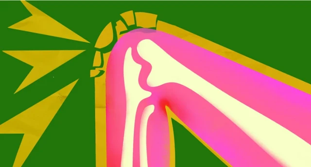 صورة ملونة تظهر العضلات الداخلية في الركبة.