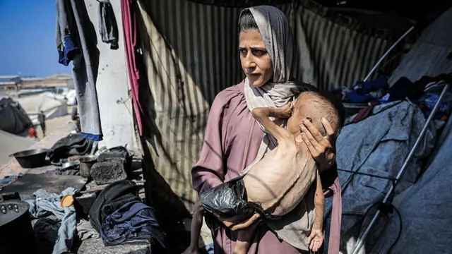 ਕੁਪੋਸ਼ਣ