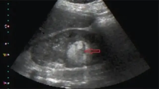 Dokita n lo ẹrọ Ultrasound lati mọ boya obinrin ni oyun iju
