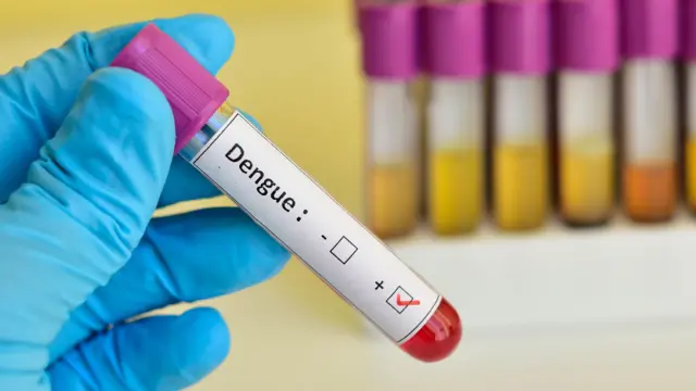 ડેન્ગ્યુનો ટેસ્ટ