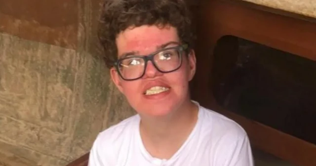 ፍራሰር ማልኮም ከሆስፒታል ለመውጣት ዝግጁ ነው ቢባልም ለሦስት ዓመታት ከሆስፒታል አልወጣም።