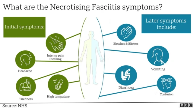 flesh-eating illness