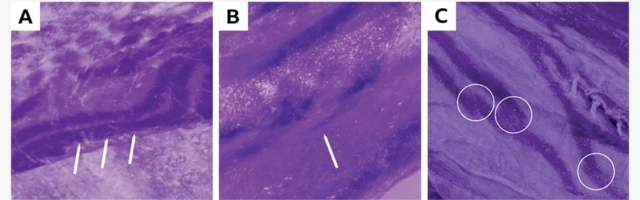 تشير السماكات المتساوية للخطوط في الصورة A إلى استخدام أداة ذات نقاط متعددة، فيما يشير الخط الرفيع في الصورة B إلى استخدام أداة منفردة، أما الخطوط المتداخلة في الصورة C فتشير إلى أنّّ الفنان كان يتوقف خلال عمله 