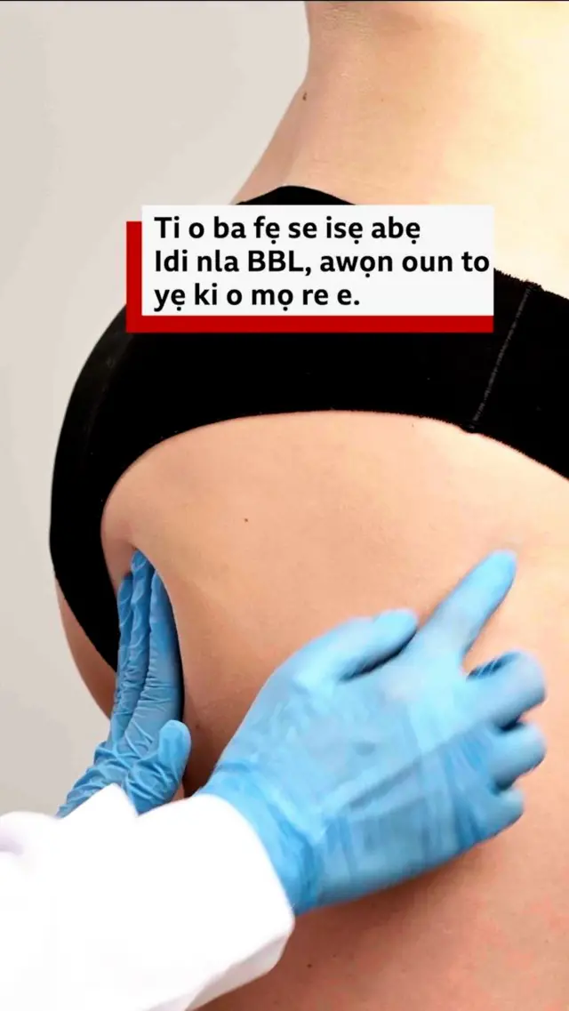 Dokita kan n se ayẹwo idi to se fun obinrin kan wo