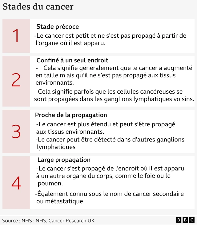 Graphique de la BBC sur les stades du cancer