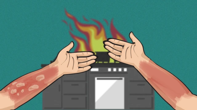 जलन भएको साङ्केतिक तस्बिर