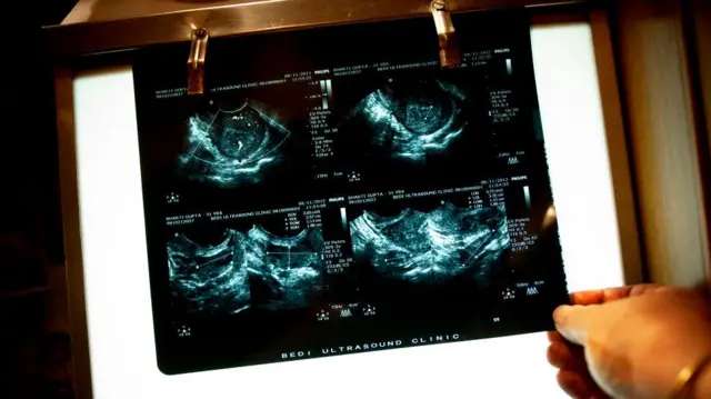 सरोगेसी