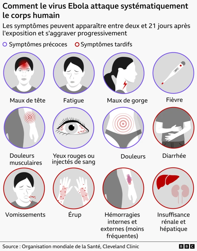 Symptomes de Ebola avec explication des symptômes précoces et tardifs