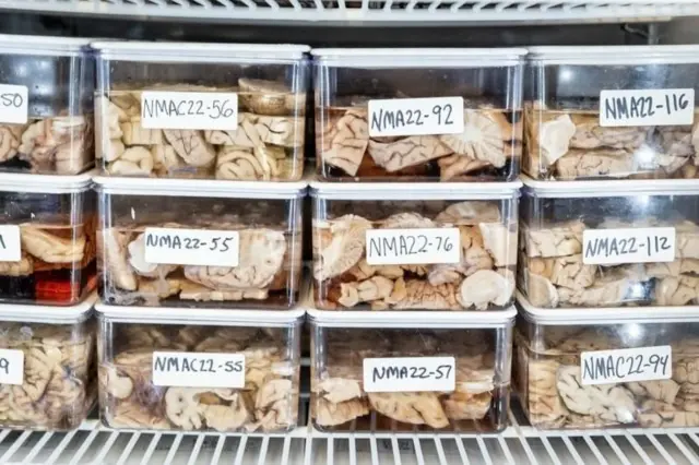 तज्ज्ञांचं म्हणणं आहे की फक्त चांगला आहार, चांगली झोप किंवा दारू सोडल्यामुळे कोणी अचानक सुपरएजर होत नाही