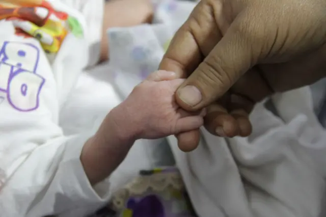 အာဟာရချို့တဲ့နေတဲ့ ကလေးငယ်တစ်ဦး