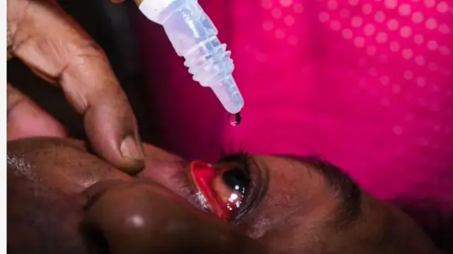 Aworan oju to pọn dẹdẹ ti wọn n kan oogun si