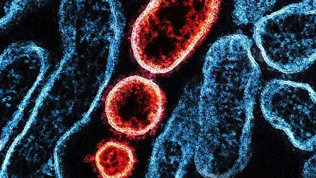 Colorised transmission electron micrograph of mature extracellular Nipah virus particles (red) near the periphery of an infected VERO cell (blue)